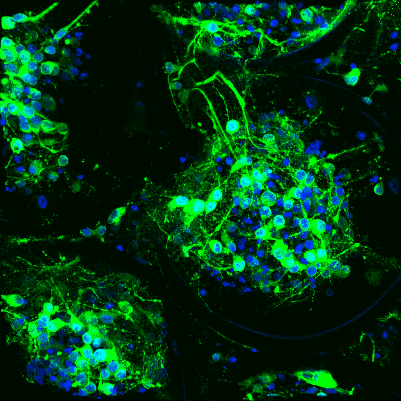 3D human iPSC-derived neuronal network developed in a laser fabricated scaffold. Green: neurons stained with MAP2 neuronal marker; Blue: DAPI nuclear staining.